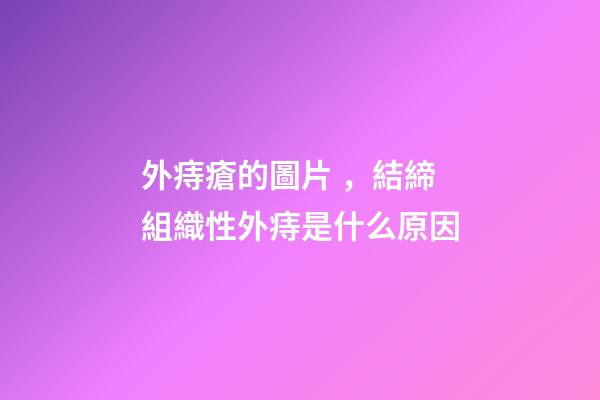 外痔瘡的圖片，結締組織性外痔是什么原因-第1張-觀點-玄機派